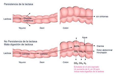 Esquema de la digestión de la lactosa en personas con y sin intolerancia
