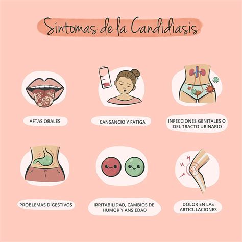 Esquema ilustrativo de los síntomas comunes de la candidiasis vulvovaginal y diferenciación con otras infecciones