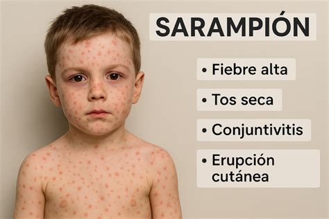 Erupción de sarampión en diferentes etapas y ojos rojos