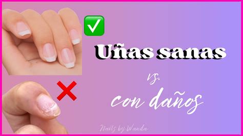 Infografía comparativa de uñas sanas y uñas dañadas, destacando los beneficios de un removedor sin acetona.