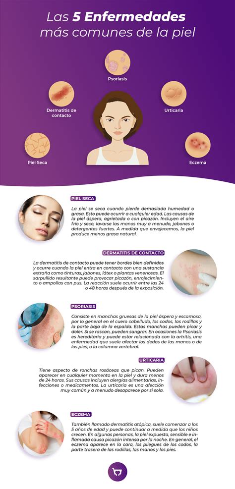 Esquema de las principales afecciones del frambueso según la parte de la planta afectada (raíces, tallos y frutos)