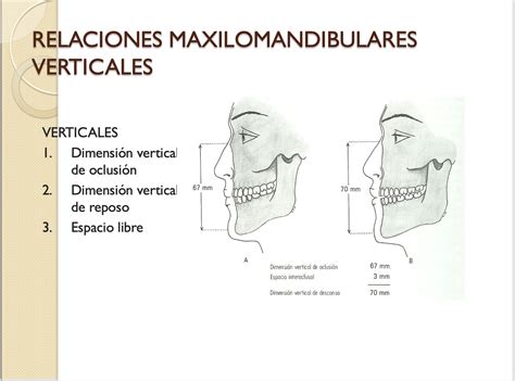 Esquema de las relaciones maxilomandibulares