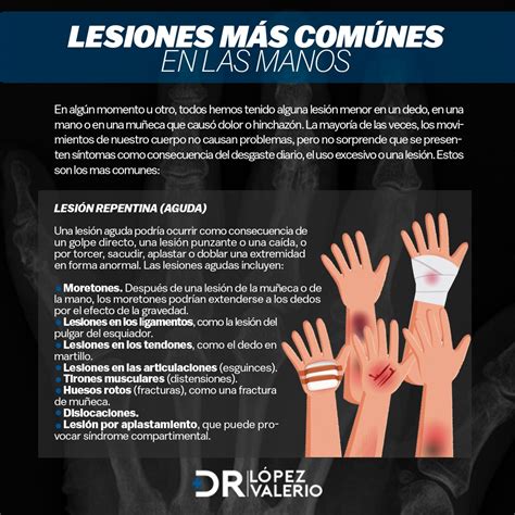 infografía sobre tipos de lesiones en las manos