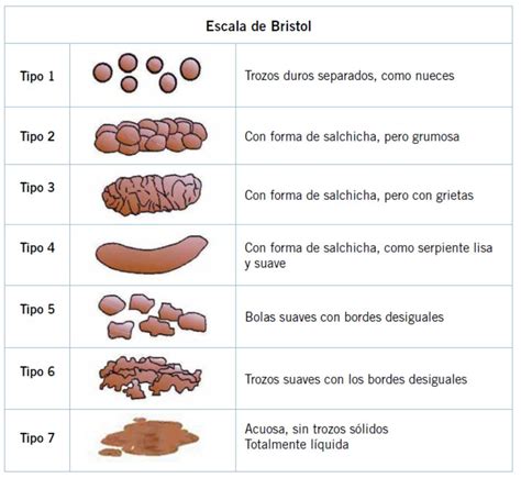 Esquema visual de las heces normales de conejo vs. anormales (tamaño, forma, consistencia)