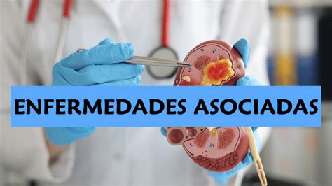 Esquema visual de las enfermedades asociadas al consumo frecuente de comida rápida y carnes procesadas