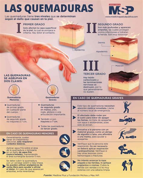 Infografía: Estadísticas globales de quemaduras y su impacto en la salud