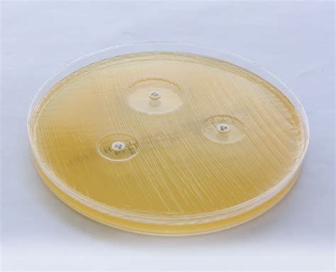 Imagen de una placa de agar Mueller-Hinton con zonas de inhibición de diferentes tamaños alrededor de los discos de antibióticos