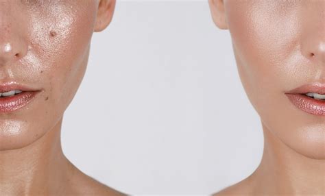 Esquema comparativo entre las necesidades de la piel del rostro (más grasa y delicada) frente a la piel de las manos (más seca y resistente).