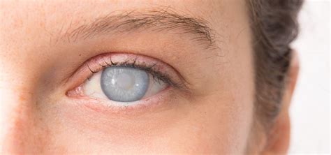 Comparativa de lineart con y sin opacidad de boceto.