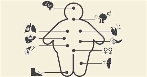 Esquema de las complicaciones de salud asociadas a la obesidad
