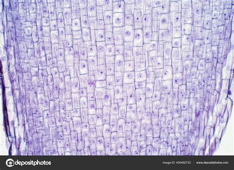 Microfotografía de células de raíz mutantes hbt mostrando expresión ectópica del marcador de raíz.