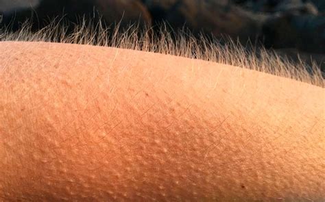 Persona con piel de gallina en el brazo debido al frío o a una emoción fuerte