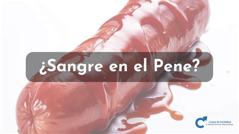 Ilustración comparativa de un pene de sangre y un pene de carne en estado erecto.