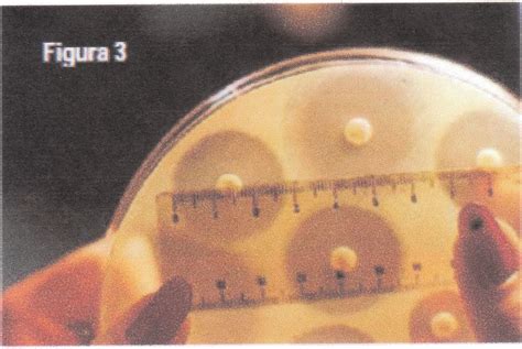 Medición de la zona de inhibición alrededor de un disco de antibiótico en una placa de agar Mueller-Hinton.