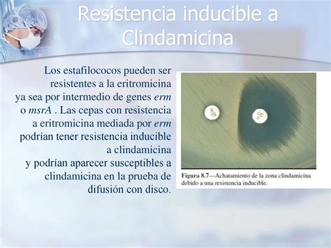 Esquema de la prueba D-test para la detección de resistencia a clindamicina en Staphylococcus.