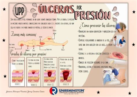 Esquema de las complicaciones más frecuentes en pacientes encamados: úlceras por presión, riesgo de trombosis, debilidad muscular y problemas respiratorios.
