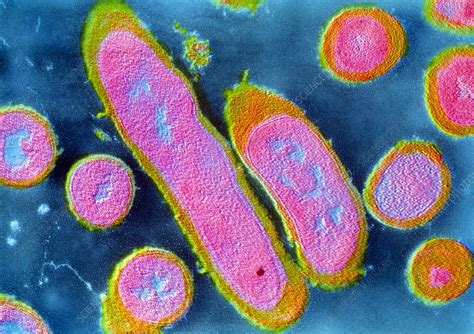 Representación microscópica de la bacteria Erysipelothrix rhusiopathiae