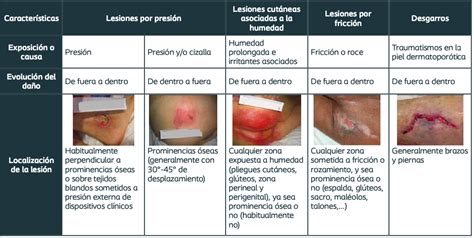 Primer plano de las características lesiones cutáneas en forma de diamante asociadas al mal rojo porcino