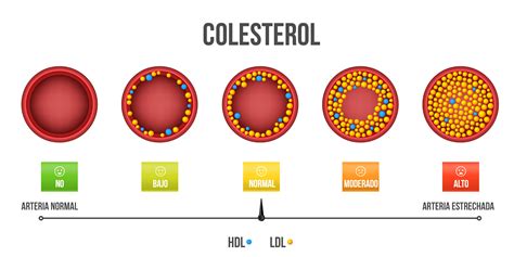 Gráfico comparativo de los contenidos de grasa y colesterol en cortes de carne magra y extramagra.