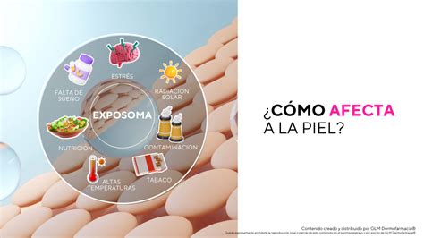 Infografía sobre los factores del exposoma y su impacto en la salud de la piel
