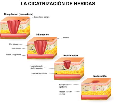 ilustración del proceso de cicatrización de la piel