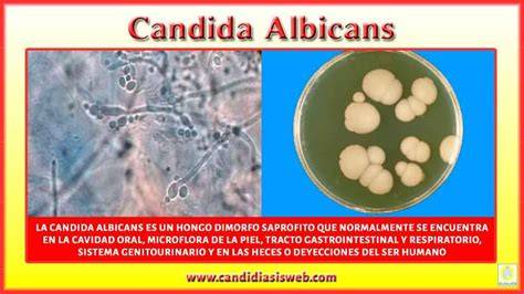 Micrografía de Candida albicans, el hongo causante de la candidiasis.