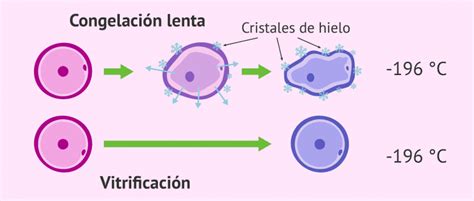 Infografía comparativa: estructura celular con congelación lenta vs. congelación rápida (criogénica).