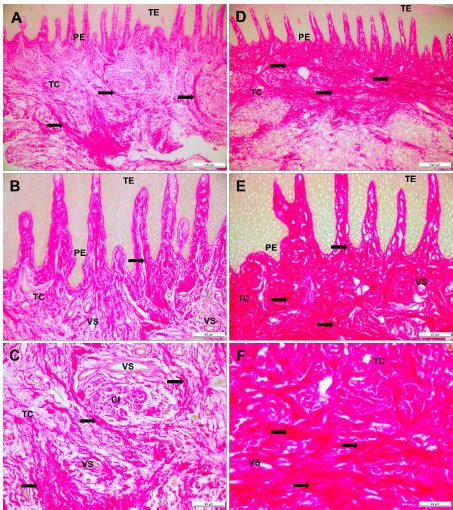 Microfotografía de tejido de bazo de salmón afectado, mostrando degeneración del tejido conectivo y esplenocitos con núcleos picnóticos.