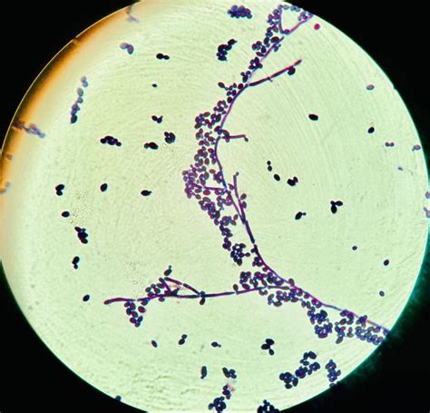 Microfotografía mostrando levaduras con gemación observadas en una tinción de Gram.