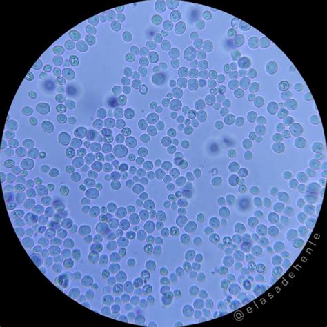 Microscopio mostrando células de levadura productoras de aceite