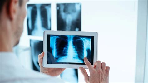 Conjunto de imágenes representando diversas pruebas diagnósticas médicas: un ECG, una radiografía de tórax, un análisis de sangre y una tomografía computarizada.