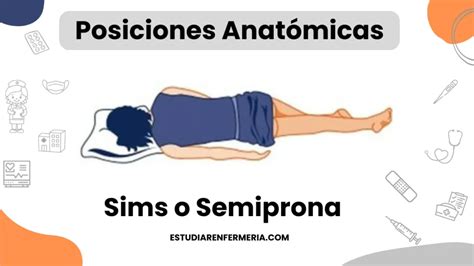 Ilustración de la posición de Sims para pacientes inconscientes