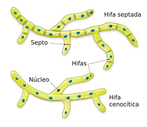 Ilustración comparativa entre hifas septadas y cenocíticas (coenocíticas).