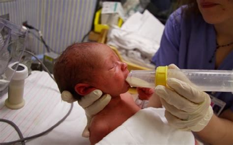 Bebé prematuro recibiendo alimentación, con énfasis en la leche materna o fortificación
