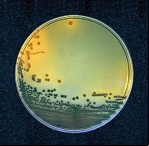 Placa de agar TCBS mostrando colonias de Vibrio cholerae y Vibrio parahaemolyticus.