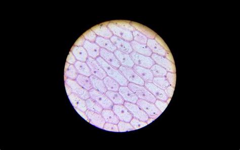 Microscopio óptico enfocado en la epidermis de cebolla