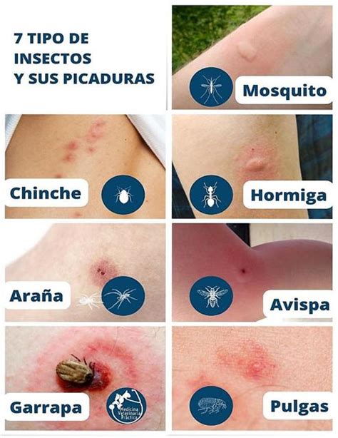 Diagrama comparativo de la frecuencia de picaduras según el tipo de sangre (O frente a A, B y AB).