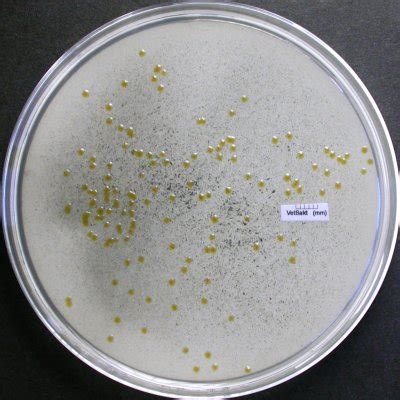 Microfotografía de Flavobacterium psychrophilum.