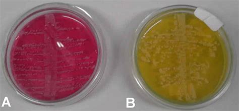 Fotografía de colonias de Staphylococcus aureus en agar manitol salado, mostrando el halo amarillo característico.