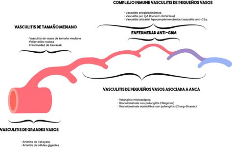 Esquema anatómico mostrando las áreas afectadas por la vasculitis en el síndrome de Behçet: ojos, piel, articulaciones, sistema digestivo y nervioso.