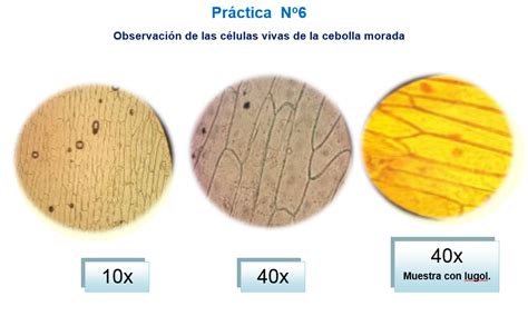 Fotografía microscópica de células de cebolla teñidas con lugol donde se aprecia el núcleo y la pared celular