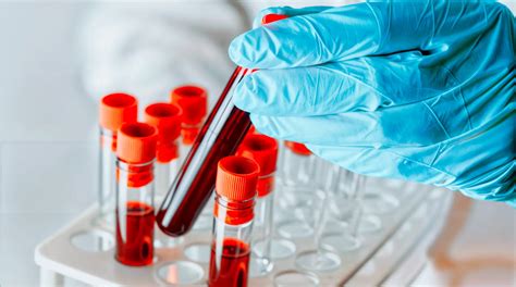 Infografía o esquema sobre los servicios de un laboratorio clínico (toma de muestras, análisis, resultados online)