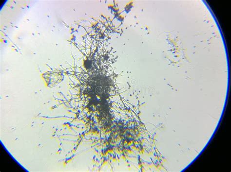 Microscopía de esporas de Penicillium expansum, causante del moho azul.