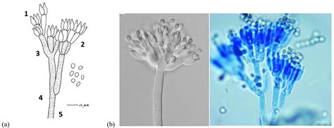 Micrografía de esporas de Penicillium y una ilustración de quesos azules y de corteza blanca.