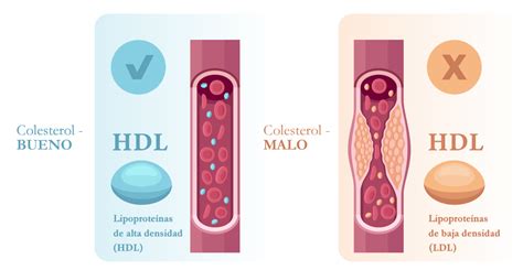Esquema sobre el papel del colesterol bueno (HDL) y el Omega-3 en la protección de las arterias y el sistema cardiovascular.