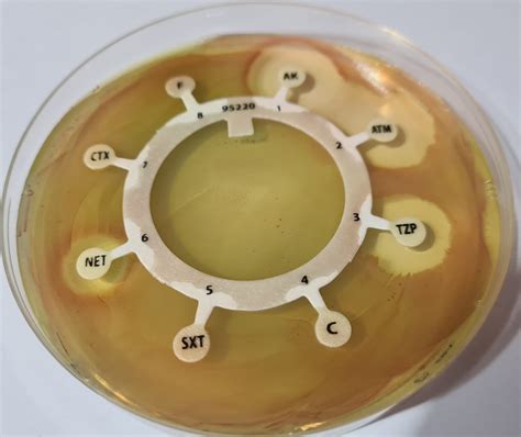 Placa de Agar Mueller Hinton para cultivo y antibiograma