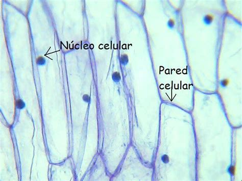 Micrografía de células de cebolla mostrando la pared celular y el núcleo
