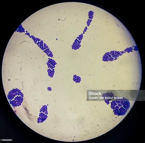 Micrografía de Candida auris