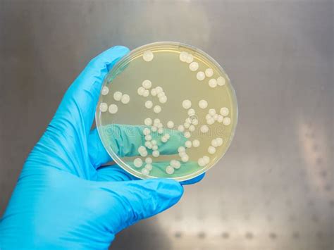 Microfotografía de colonias bacterianas aisladas en una placa de Petri