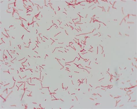 Microfotografía de bacilos teñidos con safranina (Gram negativos)